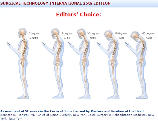 【海外発！Breaking News】携帯使用時の前のめり姿勢、文字入力で頸椎への負荷は最大27kgにも！（米）