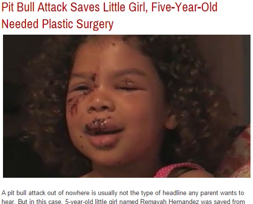 【海外発！Breaking News】顔面に大怪我の5歳女児。襲ったのは飼い犬のピットブルか、隣人宅のラブラドールか。（米）
