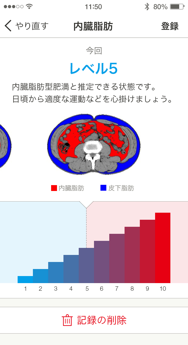 健康診断で6割以上が「異常」を発見。京セラの「デイリーサポート」で生活習慣改善を。