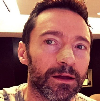 ヒュー・ジャックマン、定期検査の重要性訴える（出典：https://www.instagram.com/thehughjackman）