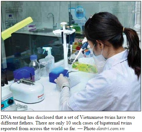 DNA鑑定で双子の父親が違うと判明（出典：http://vietnamnews.vn）