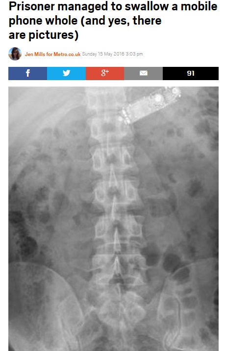 受刑者、携帯電話を飲みこみ開腹による摘出手術（出典:http://metro.co.uk）