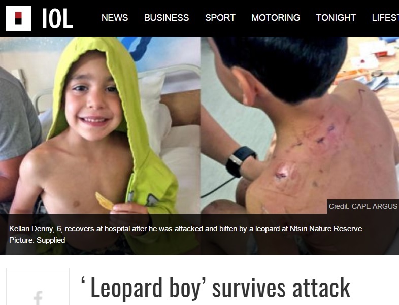 ヒョウに襲われた6歳児（出典：http://www.iol.co.za）