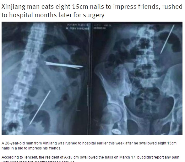 ウケを狙ってクギを飲み込んだ男性が救急搬送（出典：http://shanghaiist.com）