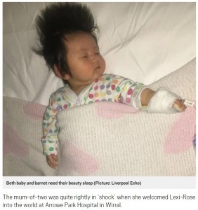 寝ている時もご覧の通りフサフサ！（画像は『Metro　2018年5月5日付「No, this five-month-old baby is not wearing an Elvis wig」（Picture: Liverpool Echo）』のスクリーンショット）