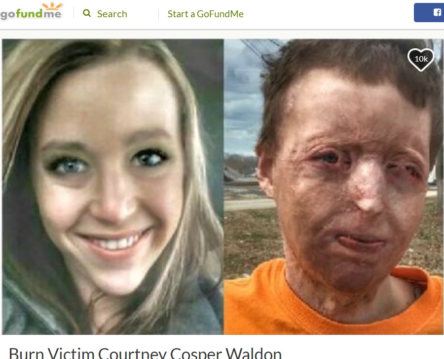 事故前（左）と事故後のコートニーさん（画像は『GoFundMe　2017年1月17日付「Burn Victim Courtney Cosper Waldon」』のスクリーンショット）