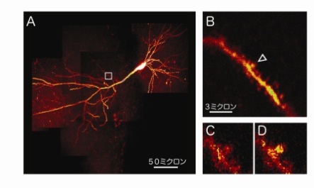 脳はどのように情報を記憶するか　北海道大学が神経細胞どうしの情報伝達の瞬間を画像化することに成功