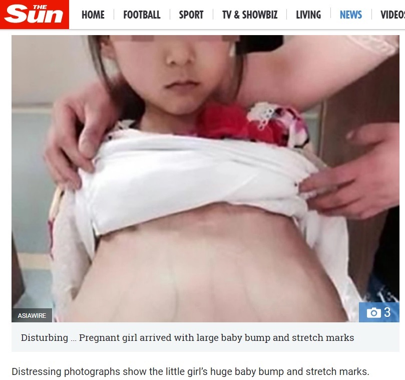 妊娠し病院にやってきた少女はあまりに幼く（出典：https://www.thesun.co.uk）