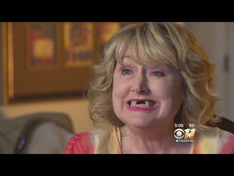 前歯を失ってしまった女性（画像は『CBSDFW　2017年7月3日公開 YouTube「Woman Wakes Up From Minor Surgery With Front Teeth Missing」』のサムネイル）