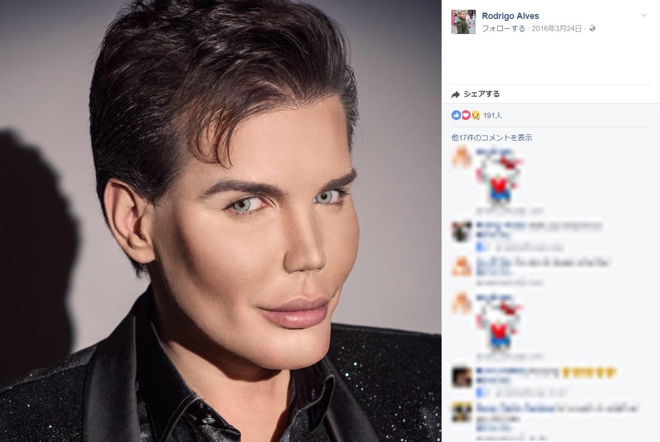 リアル・ケン、医師の言葉にショック（画像は『Rodrigo Alves　 2016年3月24日付Facebook』のスクリーンショット）