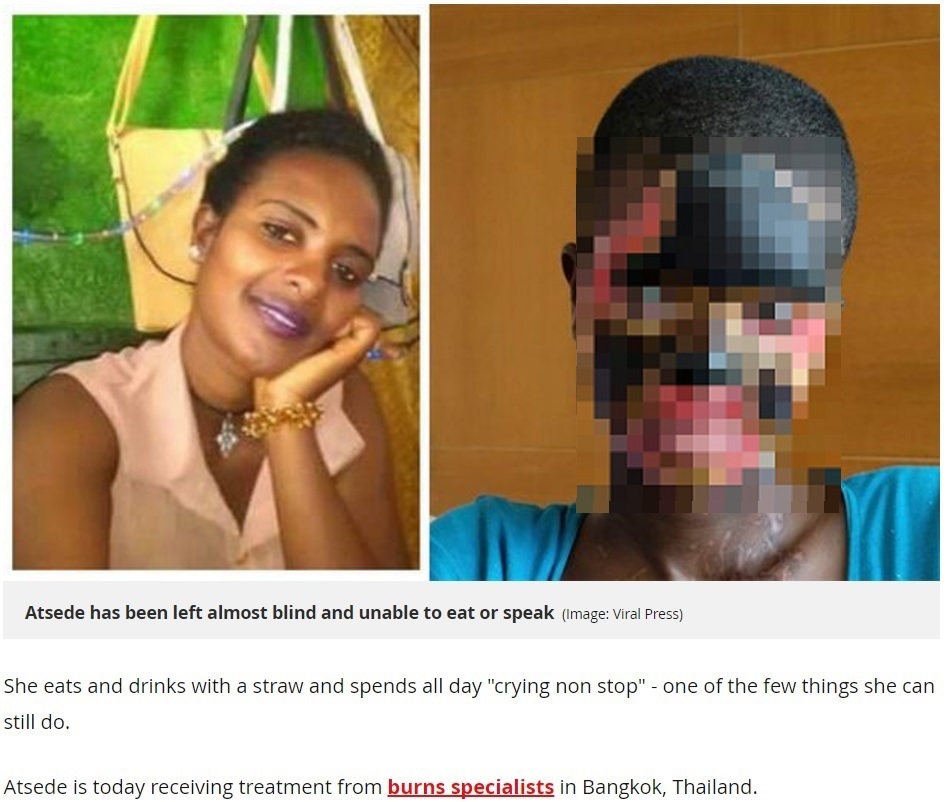 26歳女性が変わり果てた姿に（画像は『Mirror　2017年9月1日付「‘I can only cry’: Wife blinded and unable to eat or speak after acid attack by her own husband」（Image: Viral Press）』のスクリーンショット　画像を一部加工しています）