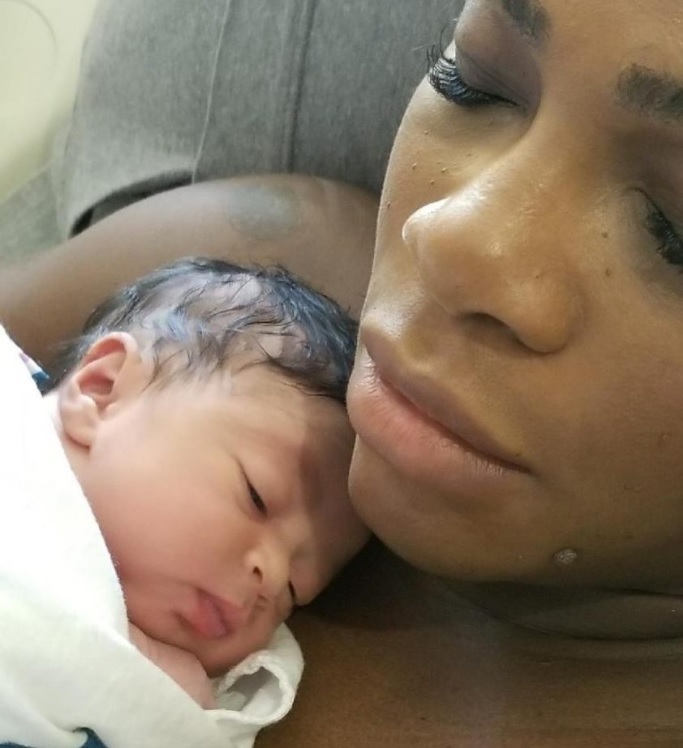 9月1日に誕生した愛娘アレクシスとセリーナ（画像は『Serena Williams　2017年9月13日付Instagram「Meet Alexis Olympia Ohanian Jr.」』のスクリーンショット）