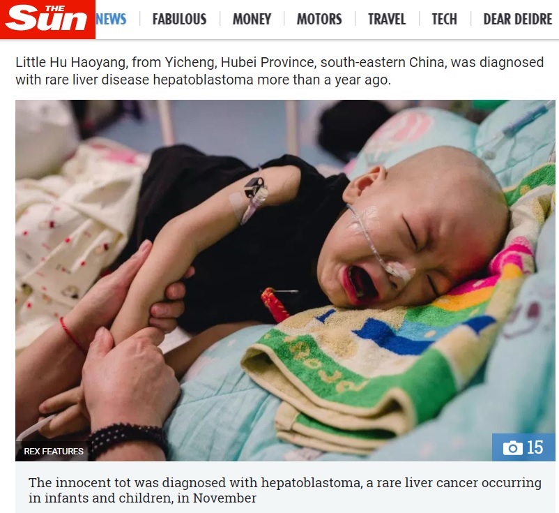 病と闘う2歳児、母親の姿を求めて号泣も（画像は『The Sun　2017年9月27日付「HOW COULD SHE? Heartbreaking pics show cancer-stricken tot crying for mum who abandoned him over his illness」（REX FEATURES）』のスクリーンショット）