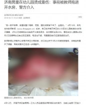 【海外発！Breaking News】幼稚園で女の教諭がヒステリー　4歳児に熱湯を浴びせる（中国）