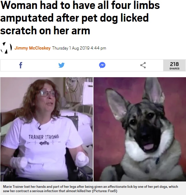 四肢切断を余儀なくされた女性と飼い犬（画像は『Metro　2019年8月1日付「Woman had to have all four limbs amputated after pet dog licked scratch on her arm」（Pictures: Fox6）』のスクリーンショット）