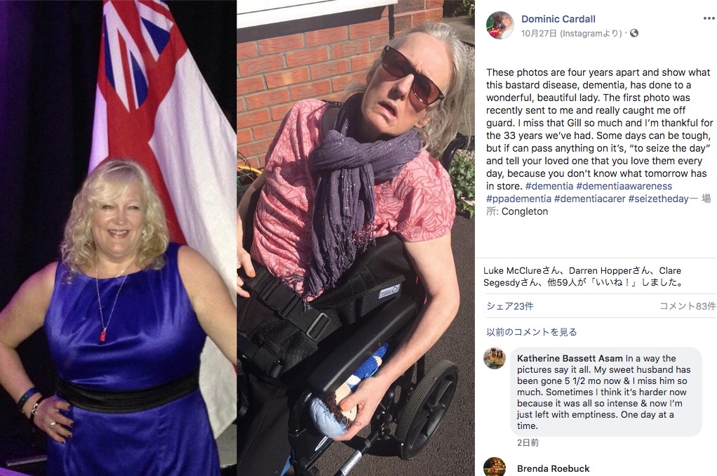 夫が勇気を持って公開した妻の写真（画像は『Dominic Cardall　2019年10月27日付Facebook「These photos are four years apart and show what this bastard disease, dementia, has done to a wonderful, beautiful lady.」』のスクリーンショット）