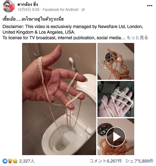 男性のお尻から出てきたサナダムシ（画像は『ตากล้อง ซิ่ง　2019年12月8日付Facebook「เชี้ยเอ้ย.....อะไรมาอยู่ในตัวกูวะเนี่ย」』のスクリーンショット）