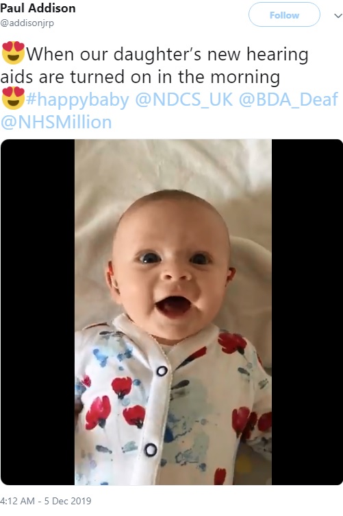 音を聞いて満面の笑みを見せる赤ちゃん（画像は『Paul Addison　2019年12月5日付Twitter「When our daughter’s new hearing aids are turned on in the morning」』のスクリーンショット）