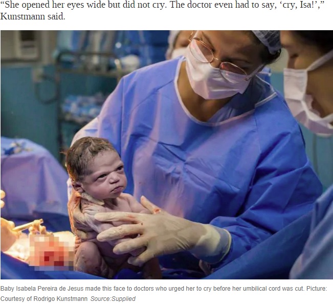 仏頂面で誕生した赤ちゃん（画像は『news.com.au　2020年2月24日付「Newborn’s seriously unimpressed facial expression moments before doctor cuts cord has internet in stitches」（Picture: Courtesy of Rodrigo KunstmannSource:Supplied）』のスクリーンショット）