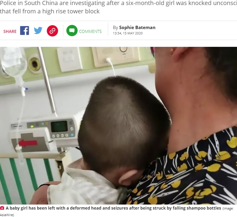 変形してしまった女児の頭（画像は『Daily Star　2020年5月15日付「Baby left with deformed head after shampoo bottles fall from high-rise and hit her）」（Image: AsiaWire）』のスクリーンショット）