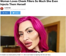 【海外発！Breaking News】フィラー注入で顔からはみ出るほどの頬を持つ女性「周りの声は気にしない」（ウクライナ）
