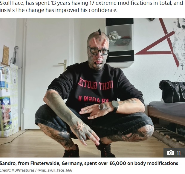 身体改造を続けるサンドロさん（画像は『The Sun　2020年8月26日付「HEAD CASE Tattoo addict chops off his own EARS and spends ￡6,000 to make his head look like SKULL」（Credit: MDWfeatures / ＠mr._skull_face_666）』のスクリーンショット）