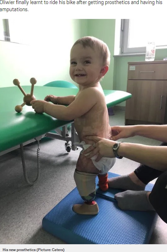 新しい義足をつけるオリヴィエ君（画像は『Metro　2020年8月30日付「Toddler who had both legs amputated due to sepsis learns to ride a bike for first time」（Picture: Caters）』のスクリーンショット）