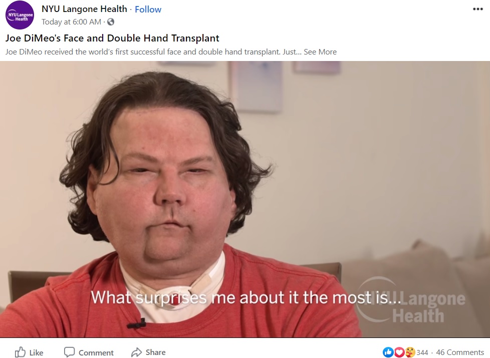 手術後、インタビューに応じるジョーさん（画像は『NYU Langone Health﻿　2021年2月4日付Facebook「Joe DiMeo’s Face and Double Hand Transplant」』のスクリーンショット）