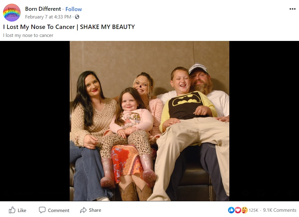 家族が支えとなっているというティナさん（画像は『Born Different　2021年2月7日付Facebook「I Lost My Nose To Cancer | SHAKE MY BEAUTY」』のスクリーンショット）