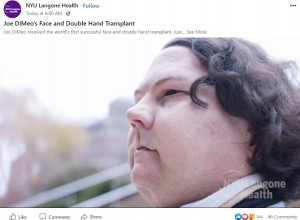 「希望を捨てずに闘ってきた」というジョーさん（画像は『NYU Langone Health﻿　2021年2月4日付Facebook「Joe DiMeo’s Face and Double Hand Transplant」』のスクリーンショット）