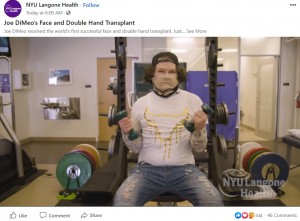 手術後に懸命にリハビリをするジョーさん（画像は『NYU Langone Health﻿　2021年2月4日付Facebook「Joe DiMeo’s Face and Double Hand Transplant」』のスクリーンショット）