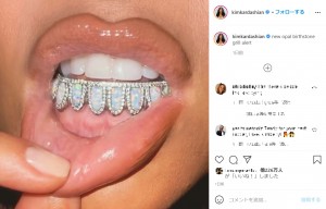 有り余る資産でグリル・コレクションを増やし続けるキム（画像は『Kim Kardashian West　2021年3月17日付Instagram「new opal birthstone grill alert」』のスクリーンショット）