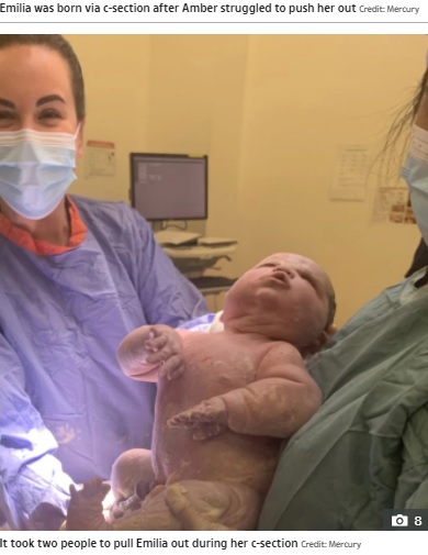 2人がかりで取り上げられたエミリアちゃん（画像は『The Sun　2021年5月1日付「WHOAH BABY First-time mum gives birth to 13lbs baby girl after her bump was SO big doctors thought she was having twins」（Credit: Mercury）』のスクリーンショット）