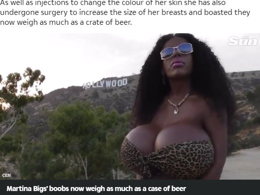 自分は100％ブラックだと語るマルティナさん（画像は『The Sun　2020年6月24日付「RACE ROW White model Martina Big who identifies as black slams white people for ‘exploiting’ the black community」』のスクリーンショット）