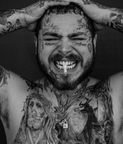 ダイヤモンドを埋め込んだ歯を見せるポスト・マローン（画像は『Thomas Connelly, DDS　2021年6月14日付Instagram「Post Malone completed his ＄1,600,000 smile reconstruction last weekend !!」』のスクリーンショット）