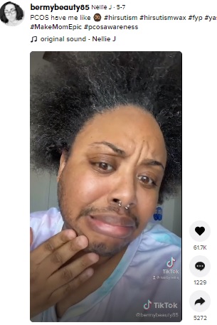 ありのままの姿を晒すネリーさん（画像は『Nellie J　2021年5月7日付TikTok「PCOS have me like」』のスクリーンショット）