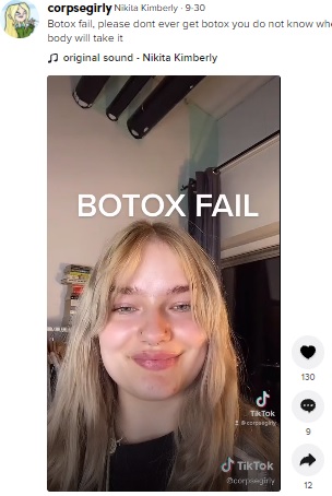 「ボトックスはやらないで」と語る女性（画像は『Nikita Kimberly　2021年9月30日付TikTok「Botox fail」』のスクリーンショット）