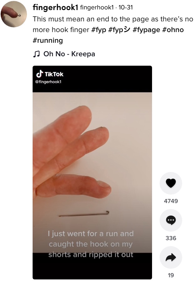 骨折した男性の指（画像は『fingerhook1　2021年10月31日付TikTok「This must mean an end to the page as there’s no more hook finger」』のスクリーンショット）