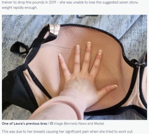 ローラさんがかつて着用していたブラジャー（画像は『The Mirror　2021年11月8日付「Woman with 4st breasts forced to fund reduction surgery after NHS ‘rejected’ her」（Image: Kennedy News and Media）』のスクリーンショット）