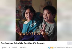 「戦い続ける」と語る2人（画像は『Born Different　2021年11月3日付Facebook「Conjoined twins Pin and Pan don’t want to be separated」』のスクリーンショット）