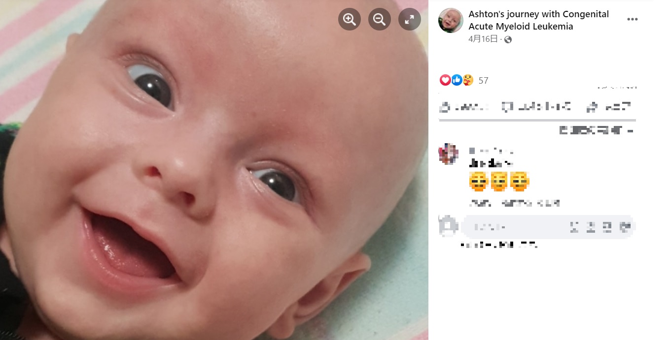 世界一のスマイルを持つアシュトン君（画像は『Ashton’s journey with Congenital Acute Myeloid Leukemia　2021年4月16日付Facebook』のスクリーンショット）