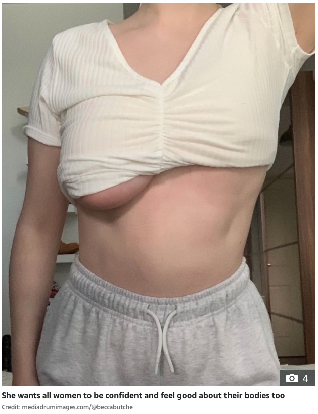 右がDカップ、左がAカップのレベッカさんの胸（画像は『The Sun　2022年1月14日付「BOOB OFF My boobs are totally different sizes - I have an A cup and a D cup - men say I show them off just to get attention」（Credit: mediadrumimages.com/＠beccabutche）』のスクリーンショット）