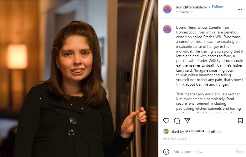 「プラダー･ウィリ症候群」のカミールさん（画像は『Born Different　2021年12月29日付Instagram「Camille, from Connecticut, lives with a rare genetic condition」』のスクリーンショット）