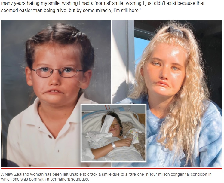 顔面の神経麻痺で笑うことができない女性（画像は『New York Post　2022年1月3日付「Woman can’t smile after being born with extremely rare condition」（Jam Press）』のスクリーンショット）