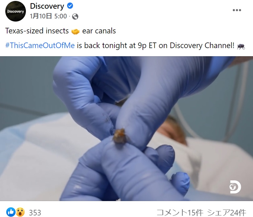 驚くことに出てきた虫はまだ生きていた（画像は『Discovery　2022年1月10日付Facebook「Texas-sized insects」』のスクリーンショット）