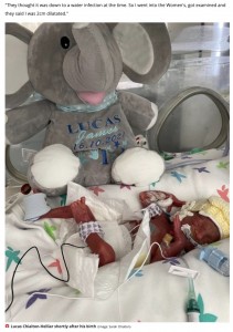 妊娠23週で誕生したルーカス君（画像は『Liverpool Echo　2022年3月11日付「‘Miracle’ baby born at 23 weeks with ‘15％ chance of survival’ finally arrives home」（Image: Sarah Chialton）』のスクリーンショット）