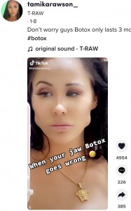 餌をほおばるハムスターのように（画像は『T-RAW　2022年1月8日付TikTok「Don’t worry guys Botox only lasts 3 months phew」』のスクリーンショット）