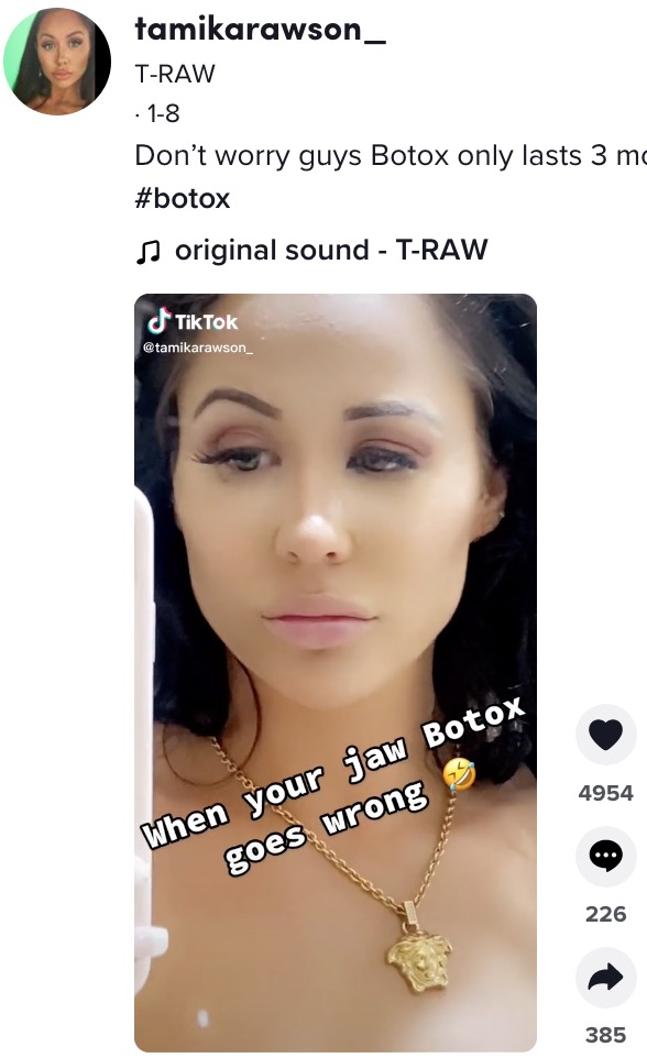 顎を小さく見せるためボトックス施術を受けた女性（画像は『T-RAW　2022年1月8日付TikTok「Don’t worry guys Botox only lasts 3 months phew」』のスクリーンショット）