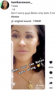 3か月後には目立たなくなるとのこと（画像は『T-RAW　2022年1月8日付TikTok「Don’t worry guys Botox only lasts 3 months phew」』のスクリーンショット）