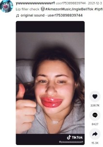 こんなに腫れた唇は見たことがない？（画像は『user1753898839744　2021年12月3日付TikTok「Lip filler check」』のスクリーンショット）